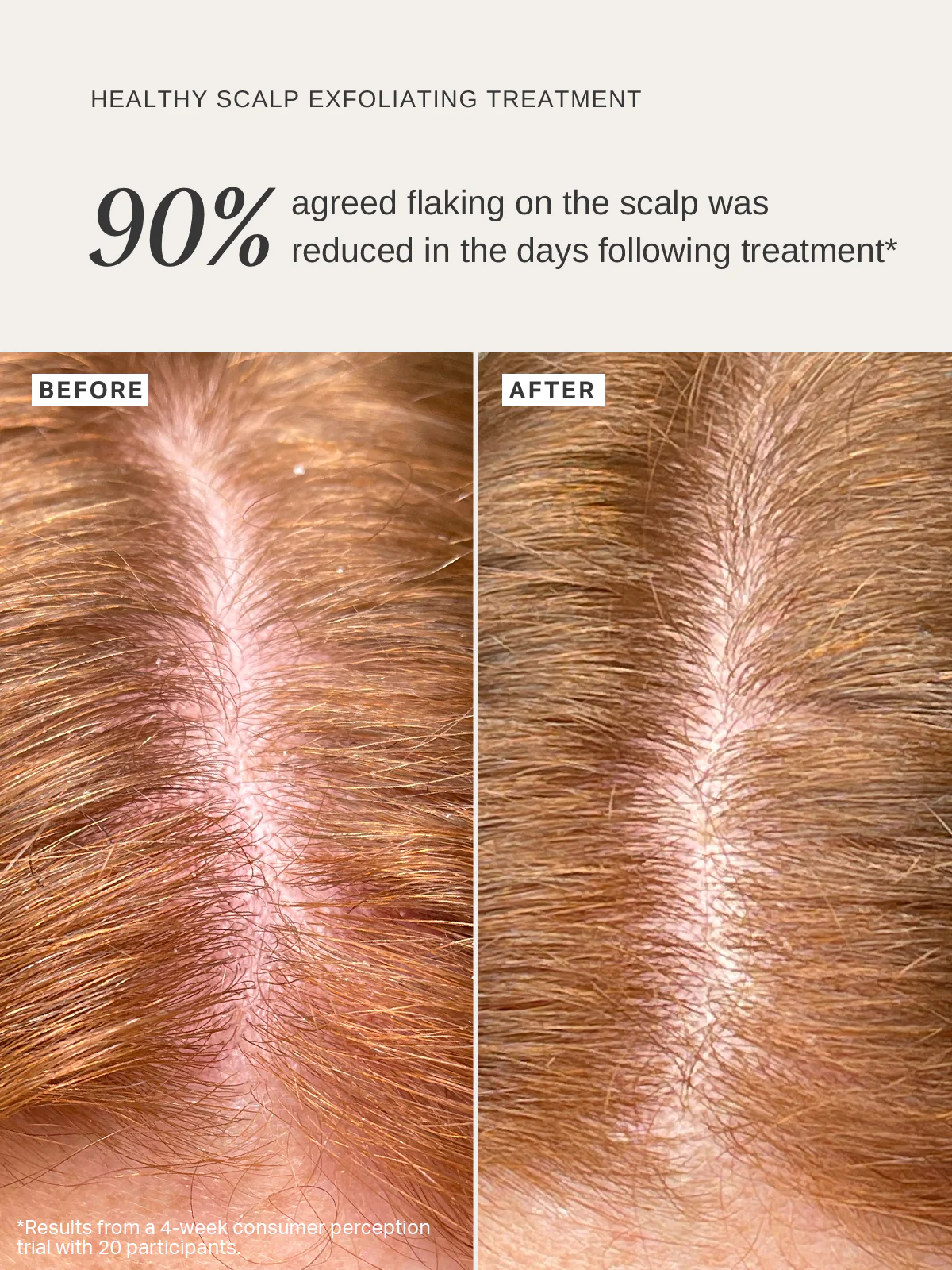 Healthy Scalp Exfoliating Treatment - Image 3