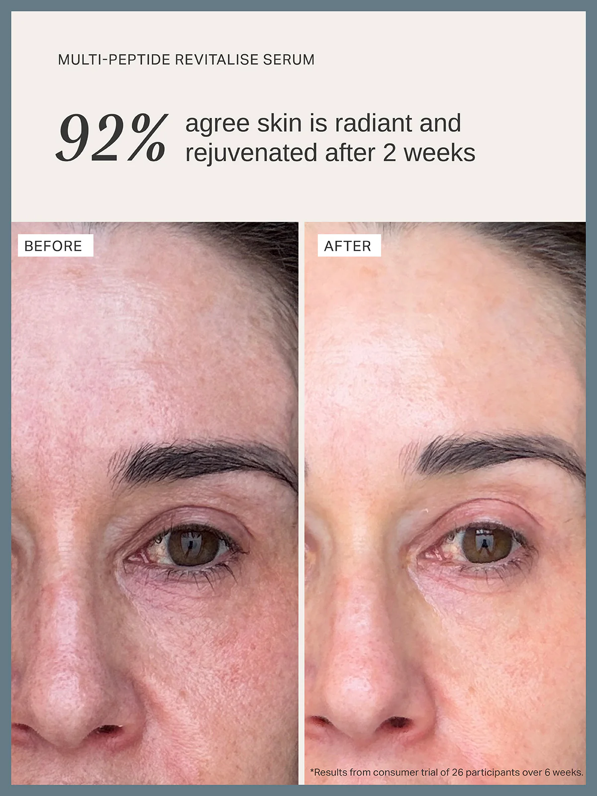Multi-Peptide Revitalise Serum - Image 5