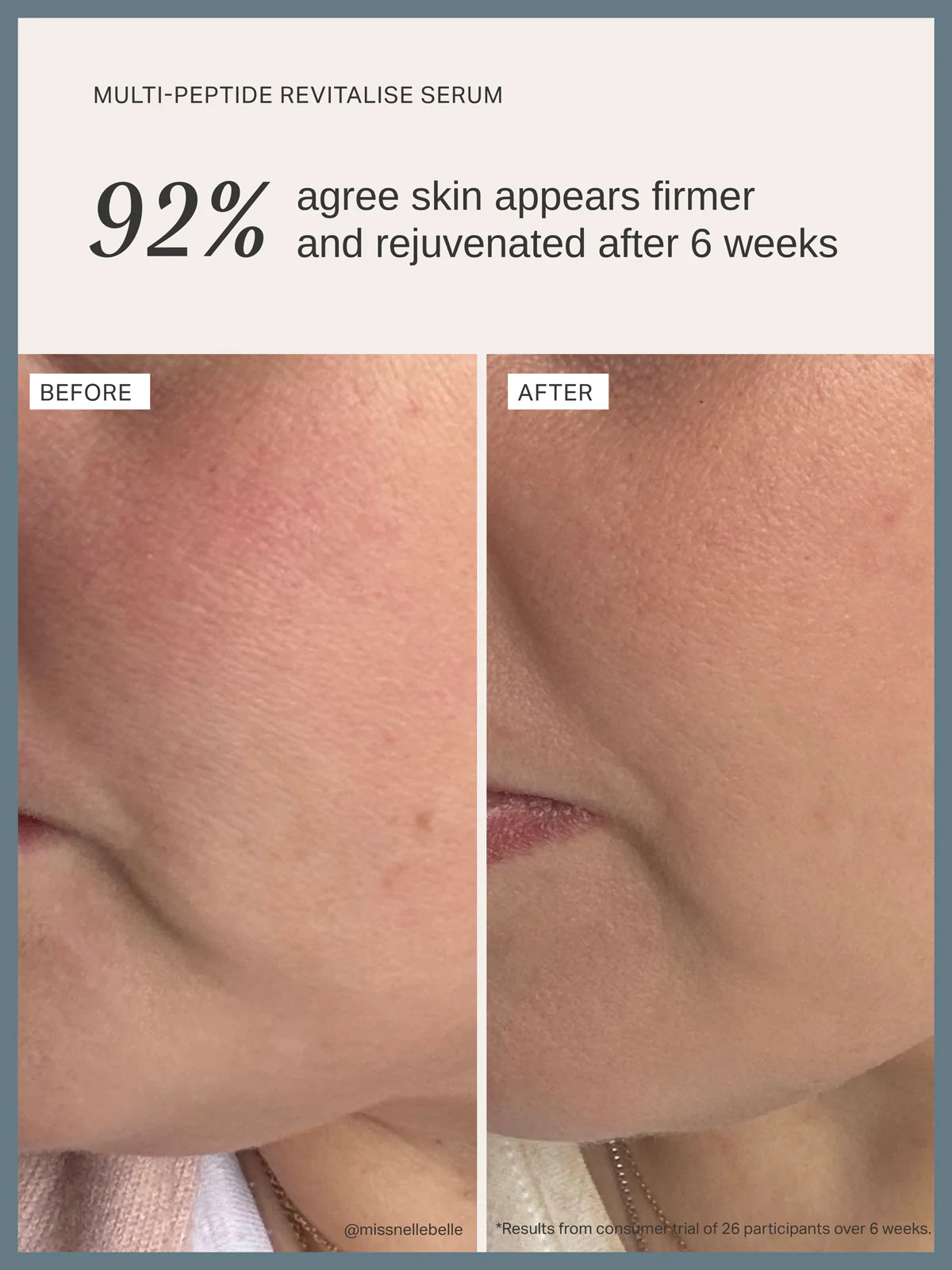 Multi-Peptide Revitalise Serum - Image 6