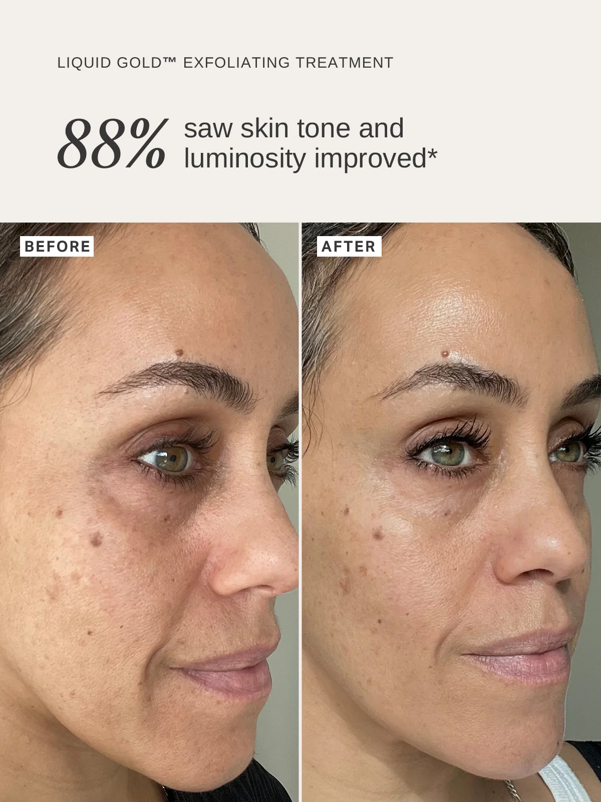 Pregnancy Skin Essentials - Image 3