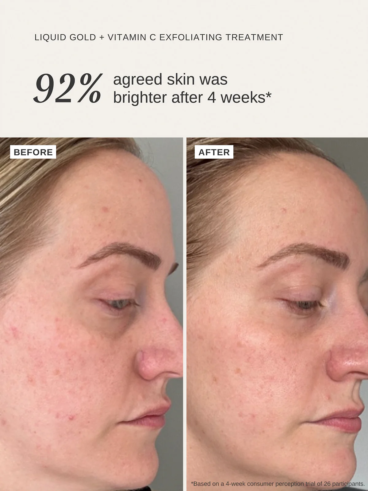 Radiance Repair Duo - Image 4