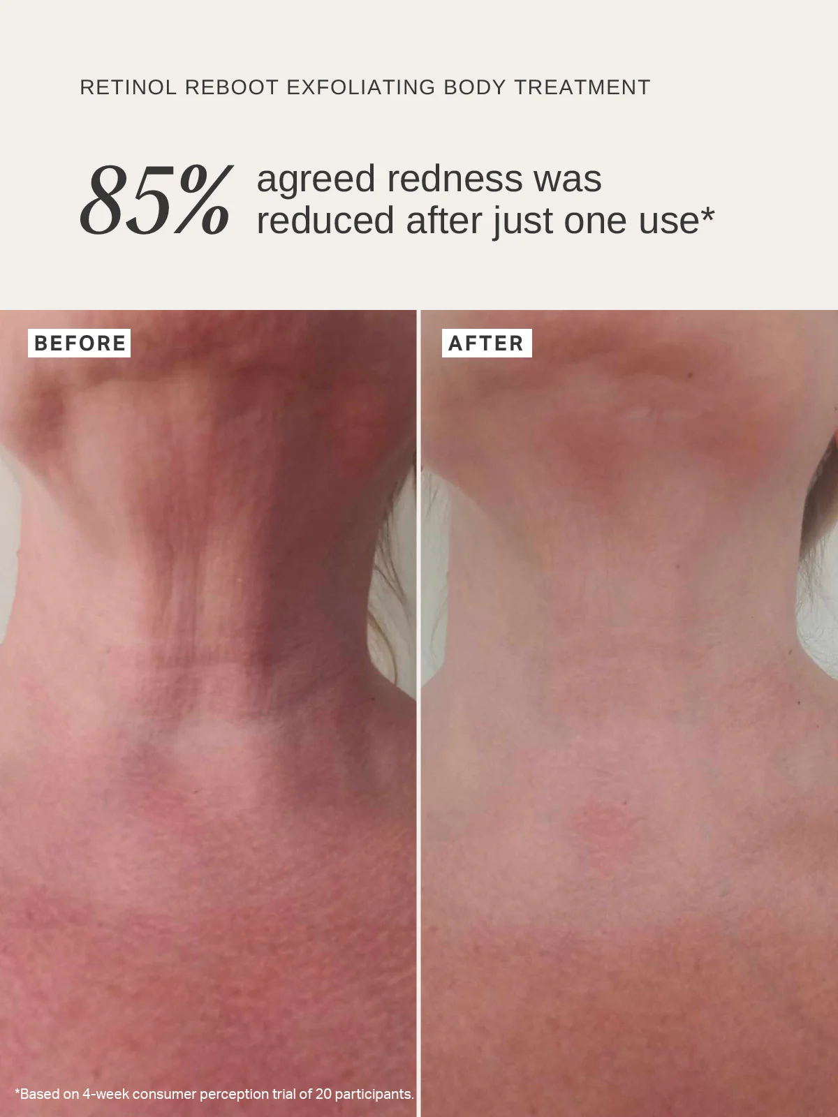 Retinol Reboot Exfoliating Body Treatment - Image 3