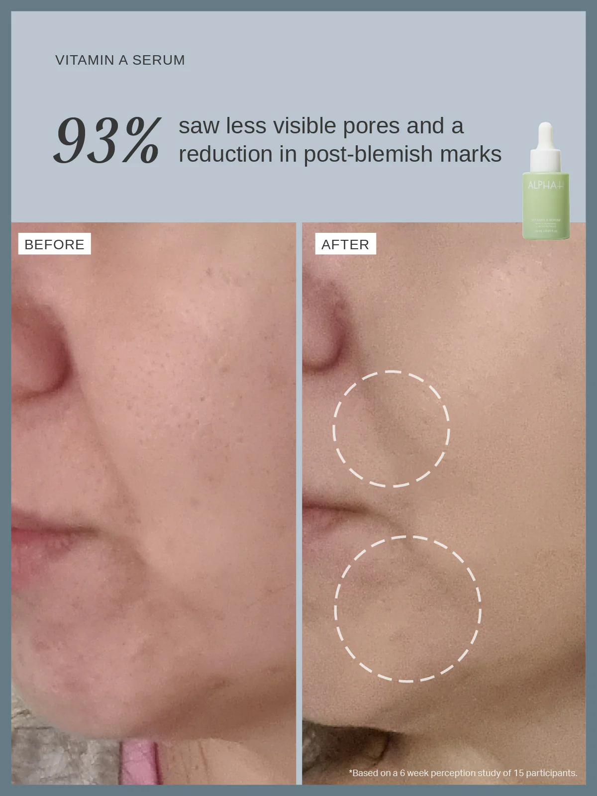 Vitamin A Serum with 0.3% Retinol and 1% Bio-Retinoid - Image 5