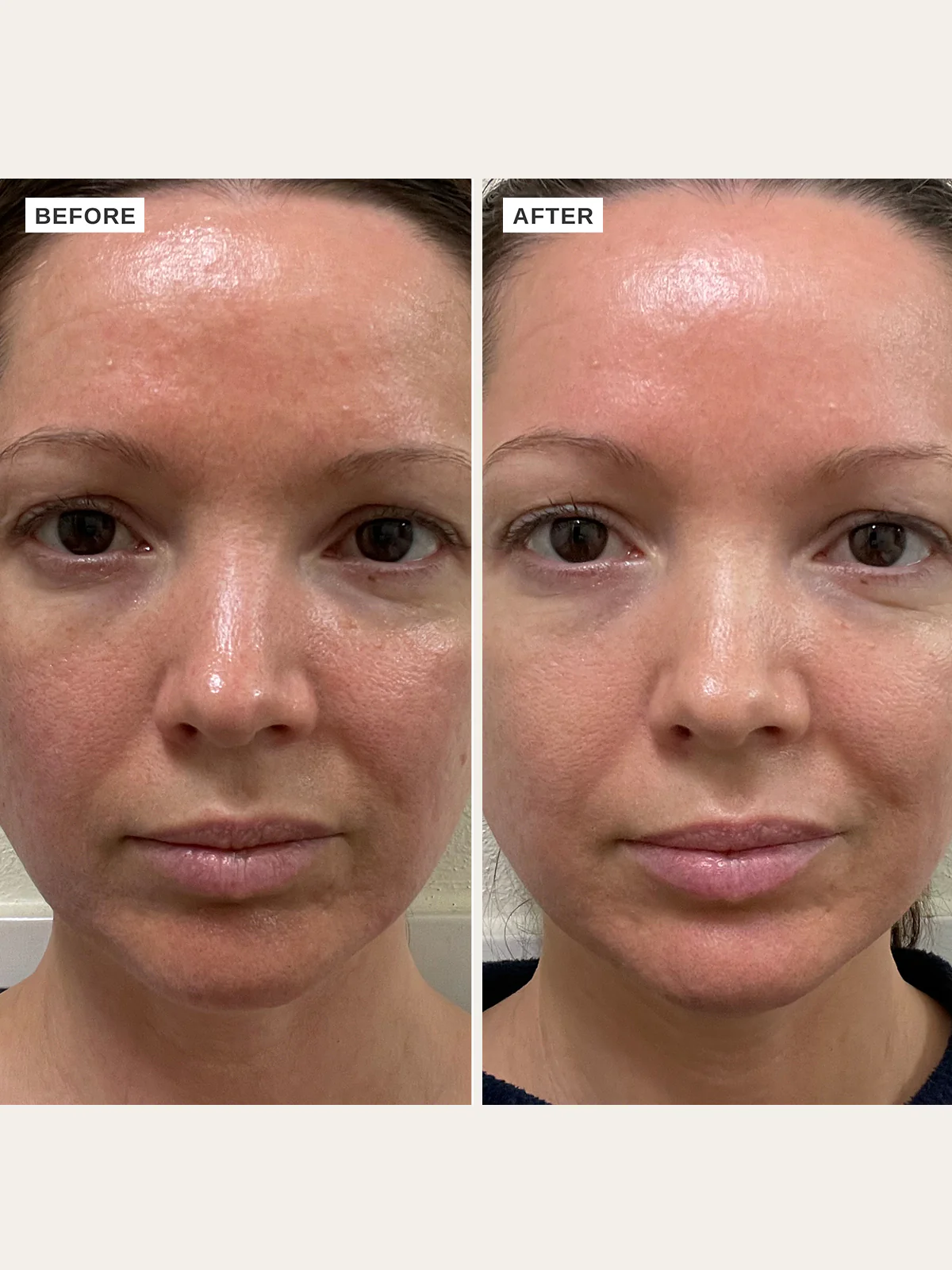 Vitamin B Serum with 5% Niacinamide 10ml - Image 3